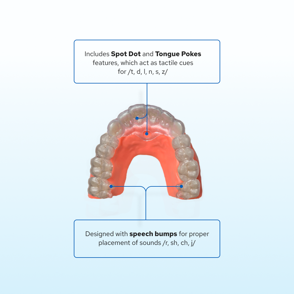 Speech Pal™ Tongue Training Applicance