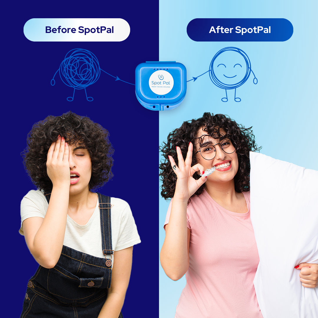 Speech Pal™ Tongue Training Applicance