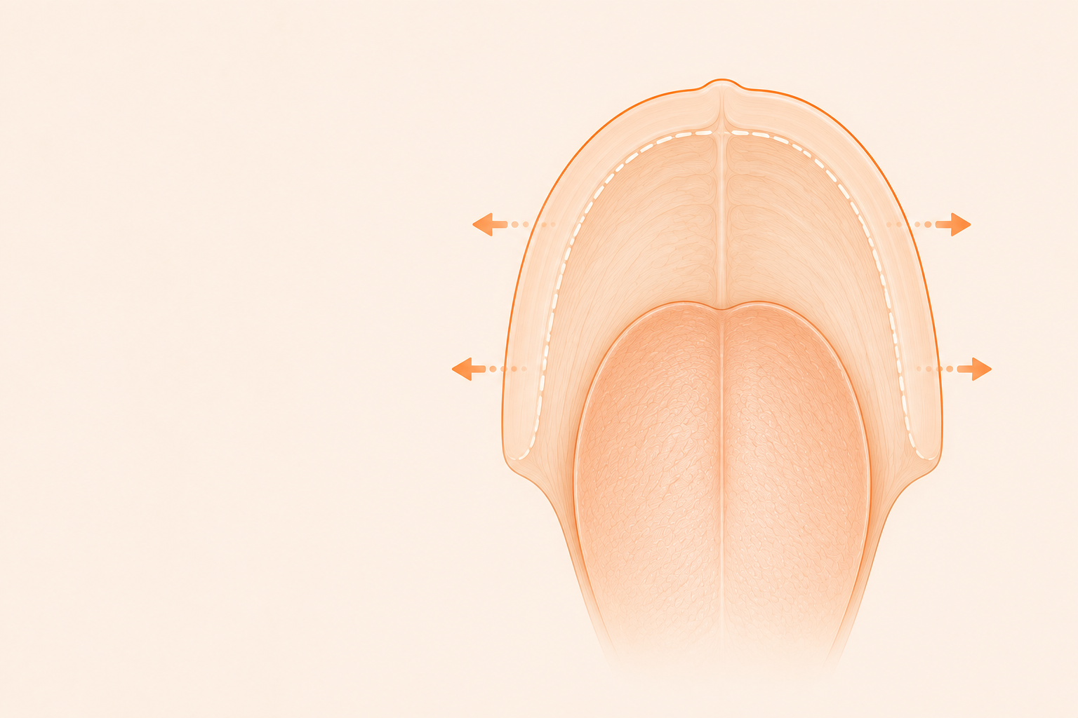 Palatal Expansion & Myofunctional Therapy: Why They Belong Together