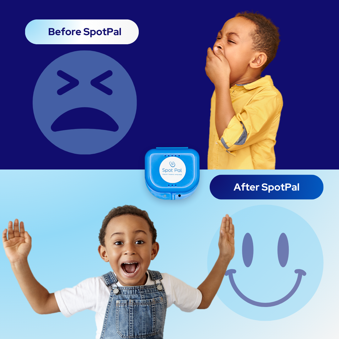 Spot Pal Tongue Training Appliance for Children + FREE Video Course