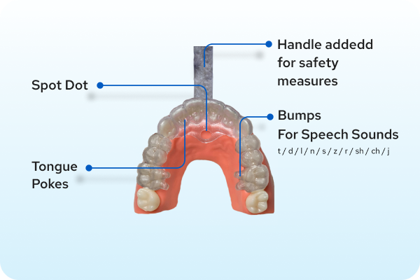 Spot Pal Mini Tongue Training Appliance for Children Age 2-4